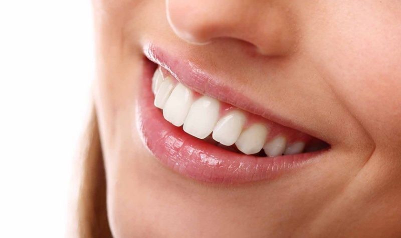 Bọc răng sứ giúp khuôn hàm hài hòa hơn