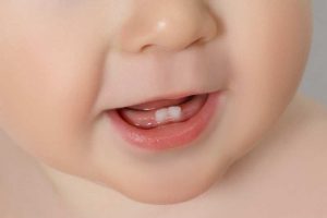 Những chiếc răng đầu tiên mọc khi trẻ 6 tháng tuổi