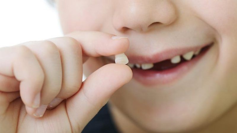 Nhổ răng sữa bị sâu phải dựa vào tình trạng của trẻ