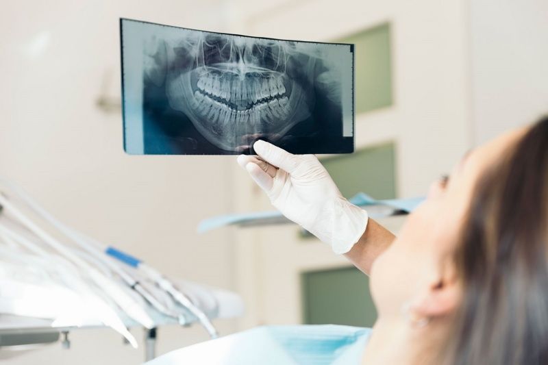 Chụp X - quang để kiểm tra chính xác tình trạng răng miệng