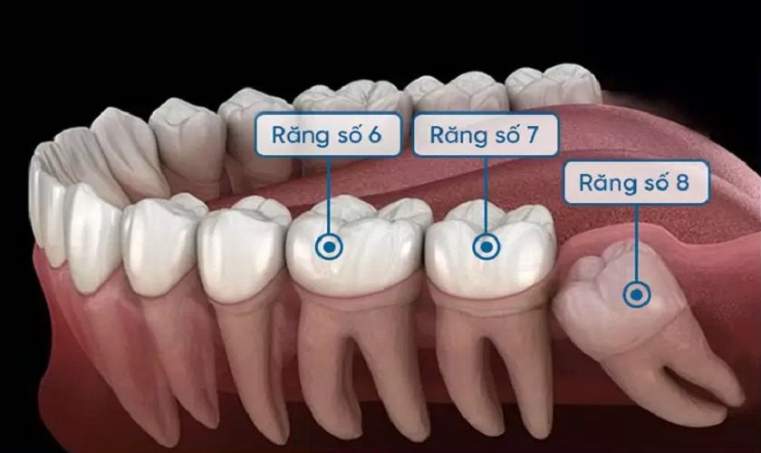 Vị trí răng cấm (răng số 6, răng số 7) trên cung hàm