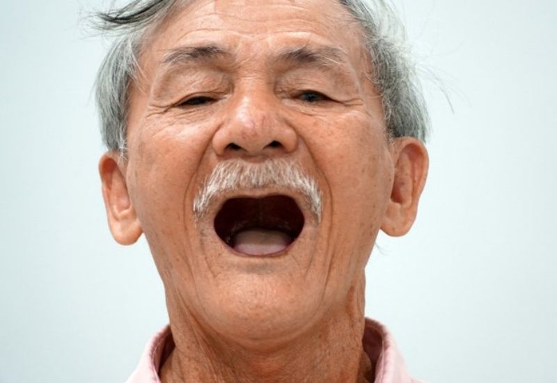 Người cao tuổi thường dễ mất răng