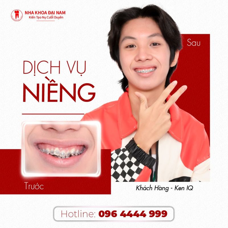 Khách hàng Ken IQ niềng răng tại Nha khoa Đại Nam Sài Gòn