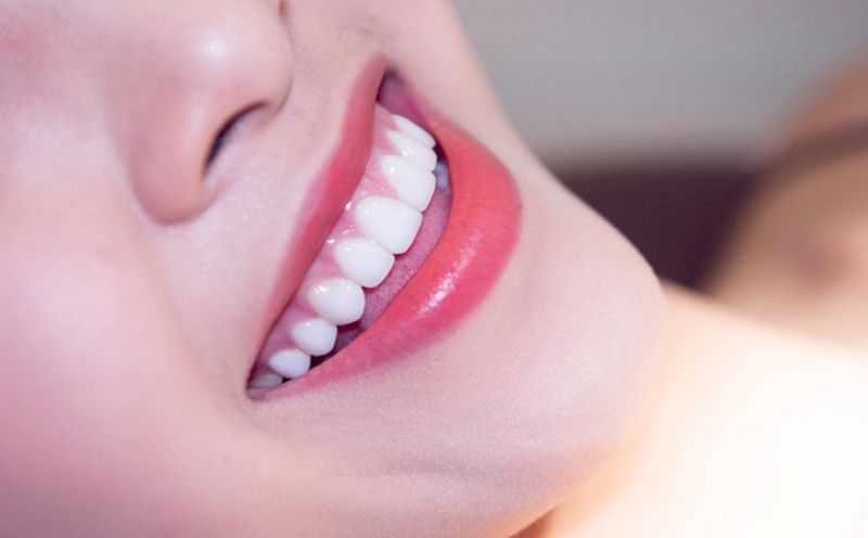 Bọc răng sứ là giải pháp phục hình thẩm mỹ tối ưu