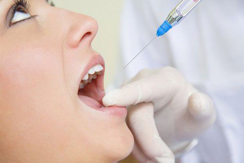 Tiêm thuốc tê để giảm đau nhức khi nhổ răng